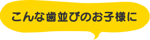 こんな歯並びのお子様に