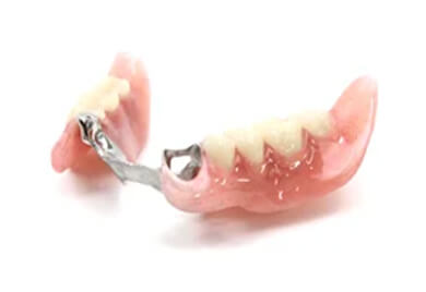 コンフォート（多数歯欠損）