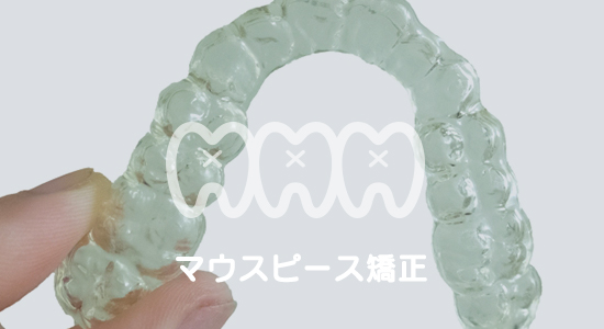 マウスピース矯正